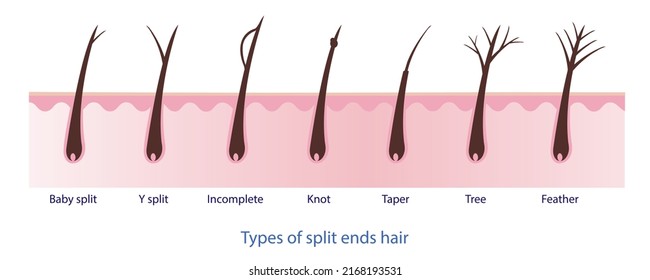 Types of split ends hair, baby split, y split, incomplete, knot, taper, tree, feather with scalp layer vector on white background. Hair care concept illustration.