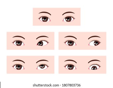 Types of strabismus vector illustration (no text)