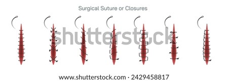 Types of surgical sutures vector illustration. Suture are used by your doctor to close wounds to your skin or other tissues. Thread is attached to a needle to stitch the wound shut. Stock photo © 