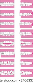 Types of tooth alignment and malocclusion. Front and side vector illustration