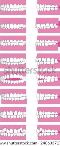 Types of tooth alignment and malocclusion. Front and side vector illustration