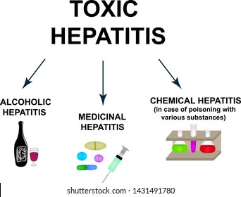 Types of Toxic hepatitis. Classification of Hepatitis A, B, C, D, E, F, G. Toxic, alcoholic, medicinal hepatitis. World Hepatitis Day. Infographics. Vector illustration