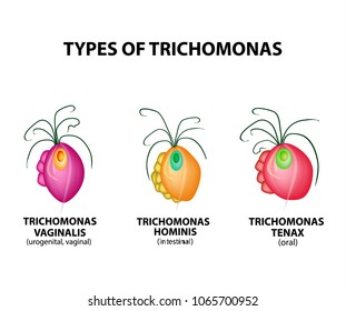 Types Trichomonads. Intestinal, oral, vaginal trichomonas structure. Trichomoniasis. Urogenital infection. Infographics. Vector illustration on isolated background.