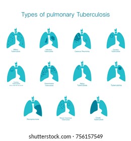 Types of tuberculosis. Vector silhouette medical illustration of human body organ - lungs with trachea. Poster for clinic, hospital. Respiratory system
