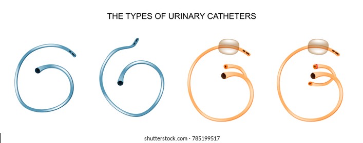 the types of urinary catheters