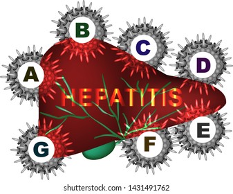 Types of viral hepatitis. Hepatitis A, B, C, D, E, F, G. World Hepatitis Day. Infographics. Vector illustration on isolated background.