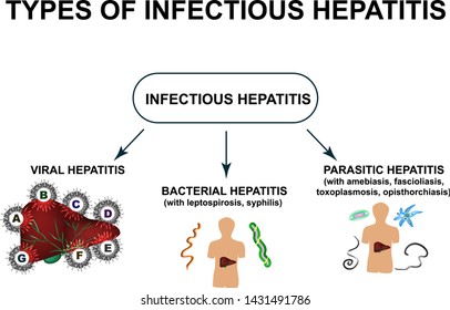 Types of viral hepatitis. Hepatitis A, B, C, D, E, F, G. World Hepatitis Day. Infographics. Vector illustration on isolated background.