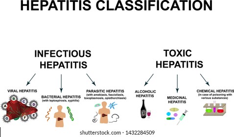 Types of viral hepatitis. Hepatitis A, B, C, D, E, F, G. World Hepatitis Day. Infographics. Vector illustration on isolated background.