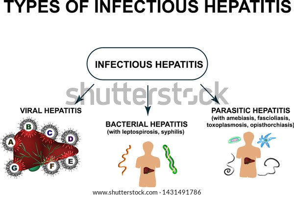 Types Viral Hepatitis Hepatitis B C Stock Vector (Royalty Free) 1431491786