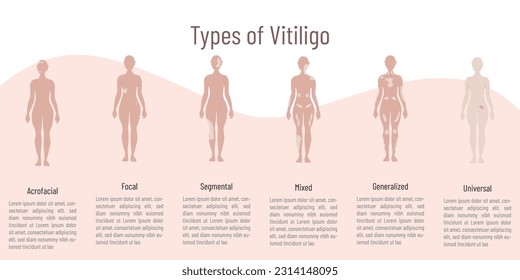 Types of vitiligo .silhouette and on it marked affected area with a lighter shade.space for text on light background.