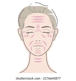 Types of wrinkles on face of woman. Vector illustration isolated on white background. - Shutterstock ID 2176645877
