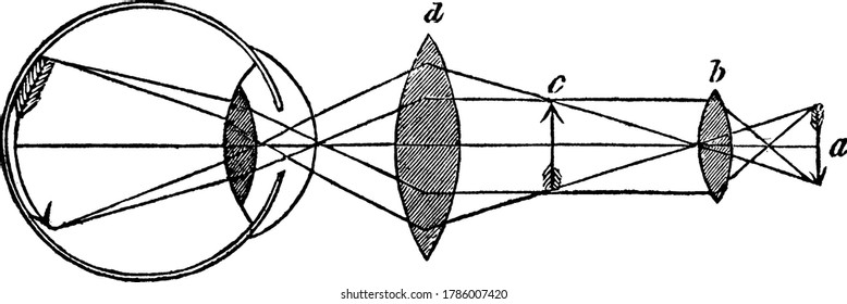 A typical representation of a compound microscope with two convex lenses, by one of which the image is formed within the tube of the instrumentand by the other this image is magnified as seen