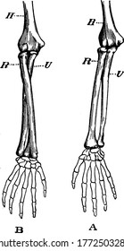 A typical representation of the human bones of the arm. Labels: A, arm in supination; B, arm in pronation. H, humerus; R, radius and U, ulna, vintage line drawing or engraving illustration.