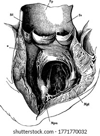 A typical representation of the left ventricle and the commencement of the aorta laid open, with its parts labelled. At the beginning of the aorta are shown its three pouch-like semilunar valves