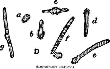 A typical representation of the various phases of germination of spores of Bacillus ramosus, as observed in hanging drops under high powers, vintage line drawing or engraving illustration.