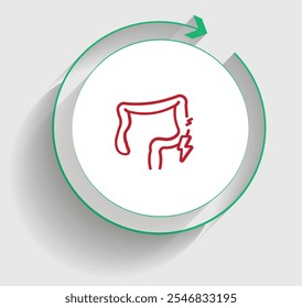 La colitis ulcerosa (CU) es una enfermedad intestinal inflamatoria crónica (EII) que afecta principalmente el colon (intestino Grande) y el recto