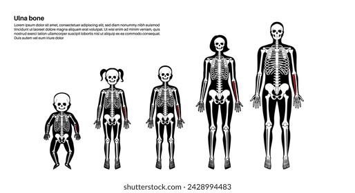 Ulna bone anatomical poster. Forearm in human skeletal system diagram. Skeleton in male, female, baby, child and adult silhouettes. Bones, cartilage and joints in body xray medical vector illustration