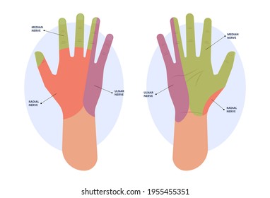 ulnar nerve muscle bone elbow swollen pain hand palm bone spurs ring little medial golfer radial arms wrist funny carpal tennis canal palsy test