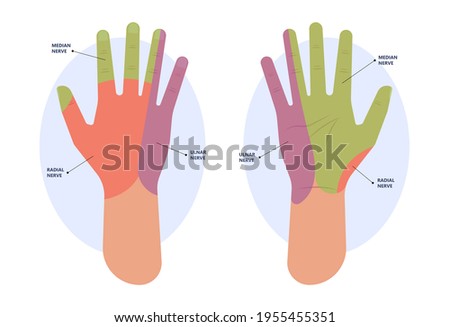 ulnar nerve muscle bone elbow swollen pain hand palm bone spurs ring little medial golfer radial arms wrist funny carpal tennis canal palsy test