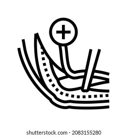 vector de icono de la línea de liberación de nervio ulnar. signo de liberación de nervio ulnar. símbolo de contorno aislado ilustración negra