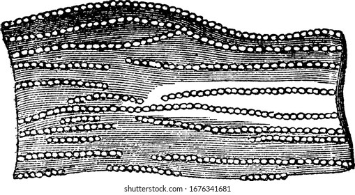 Ultimate fibers of nerve highly magnified; showing the strings of globules of which they consist. Showing nervous fiber human system in it, it vintage line drawing or engraving 