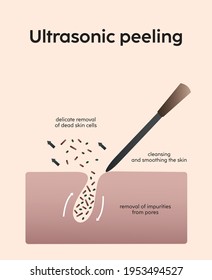 Ultrasonic peeling cleansing smoothing skin care removing dead cells cosmetology scheme infographics banner information poster for students and patients