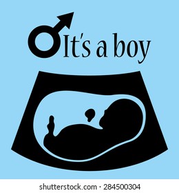 Ultrasonic picture of unborn baby. It's a boy.