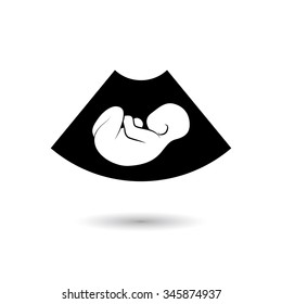 Ultrasonic picture of unborn baby. Vector illustration