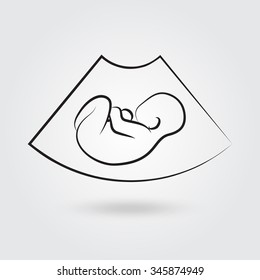 Ultrasonic picture of unborn baby. Vector illustration