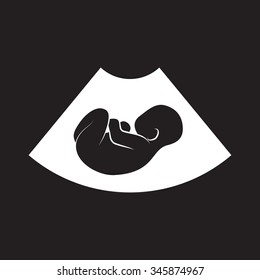 Ultrasonic picture of unborn baby. Vector illustration