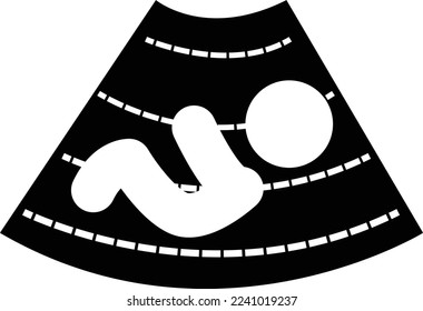 Ultrasonography baby icon on white background. Ultrasonography sign. flat style. 
