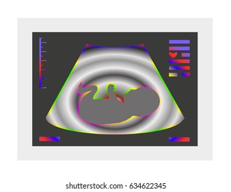 Ultrasonography. Medical. Picture of pregnancy