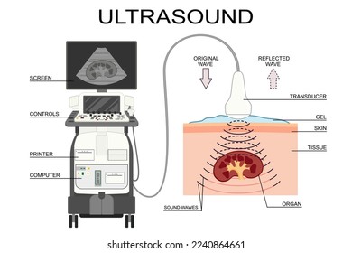 Ultrasound analysis equipment and process vector illustration. Radiology scanner for medical research and diagnosis. Sonar computer with wave reflection transducer medical poster. Kidney ultrasound.