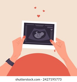 Ultrasound of baby. Female hands holding fetus silhouette photo. Embryo in womb. Pregnancy belly top view. Baby health diagnostic. Sonography or ultrasonography concept. Cartoon vector illustration.