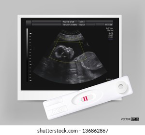 Ultrasound of baby in mother's womb and positive pregnancy test isolated on white background. Vector illustration.