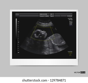 Ultrasound of baby in mother's womb. Vector illustration.