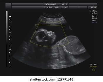 Ultrasound of baby in mother's womb. Vector illustration.