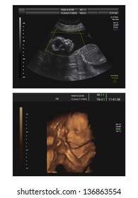 Ultrasound of baby in mother's womb. Vector illustration.