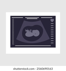 Ultrasound of a child. An ultrasound scan of the fetus of a pregnant woman. Medical diagnosis concep