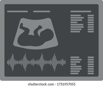 Ultrasound Diagnostic Picture With Baby Silhouette And Heartbeat, Vector Illustration