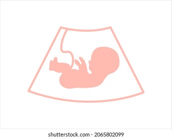 Procedimiento de examen por ultrasonido. Bebé en el útero. Embarazo y salud del niño. 

Embrión y cordón umbilical en pantalla.  Símbolo médico del centro de embarazo. 
Ilustración del vector