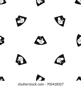 Ultrasound fetus pattern repeat seamless in black color for any design. Vector geometric illustration