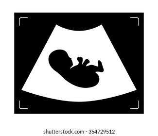 Ultrasound Icon. Maternity Icon. Ultrasound Of Baby In Mother's Womb. Medical Ultrasonic Diagnostic Machine. Vector Illustration.