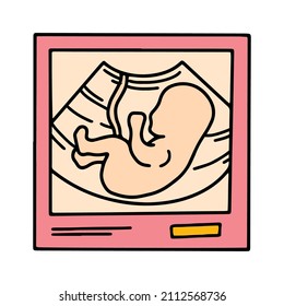 Ultrasound image with an embryo baby, pregnancy scan isolated pink icon in cartoon style