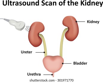 Ultrasound Of Kidney