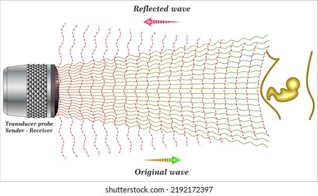 An ultrasound machine uses sound waves to create images of the inside of the human body