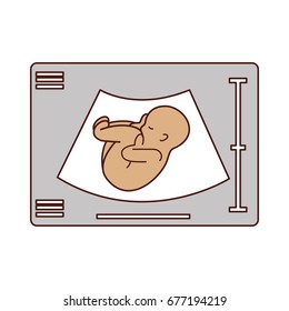 Ultrasound monitor isolated icon