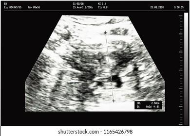 An ultrasound of a mother fetus during the 08th week background as Medical and Health of the baby concept. vector illustration.