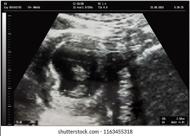 An ultrasound of a mother fetus during the 8th week background as Medical and Health of the baby concept. vector illustration.
