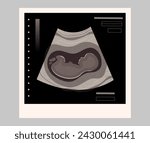 Ultrasound scan. Baby ultrasound picture. Photo of ultrasound examination of infant. Illustration how baby develops inside the womb. Picture of the mother